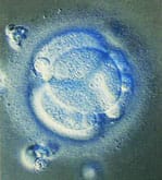 受精卵の顕微鏡写真